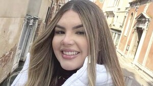 ¡Escalofriante! Estudiante de Medicina recibió 65 heridas cortantes