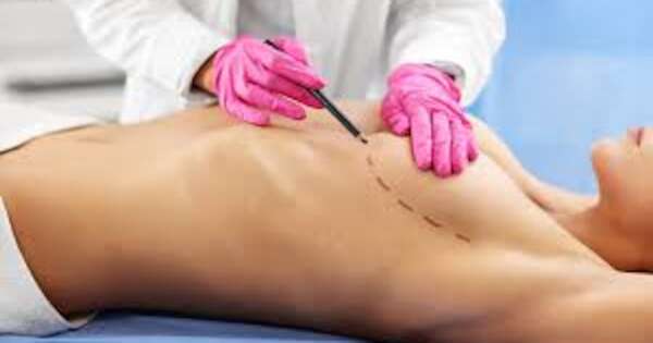 Diario HOY | Impulsan ley para garantizar reconstrucción mamaria a pacientes oncológicas