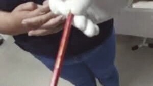 Nunca contaba nada hasta que le dañaron