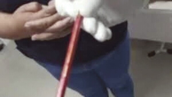 Nunca contaba nada hasta que le dañaron