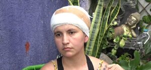 Mujer que perdió el cuero cabelludo en accidente pide ayuda para continuar su tratamiento