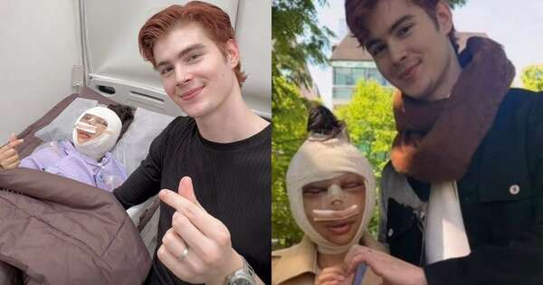La Nación / Influencer tailandesa se operó toda la cara por no sentirse linda para su novio