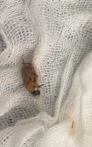 Extraen insecto del oído en la USF San Alfredo - Concepción al Día