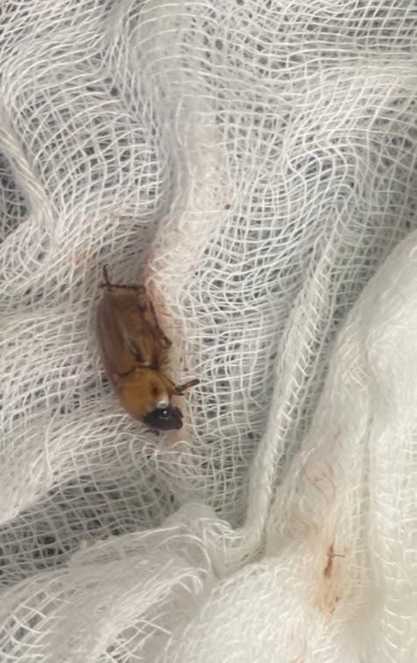 Extraen insecto del oído en la USF San Alfredo - Concepción al Día