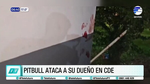 Ataque de pitbull deja a su dueño en estado crítico en Ciudad del Este