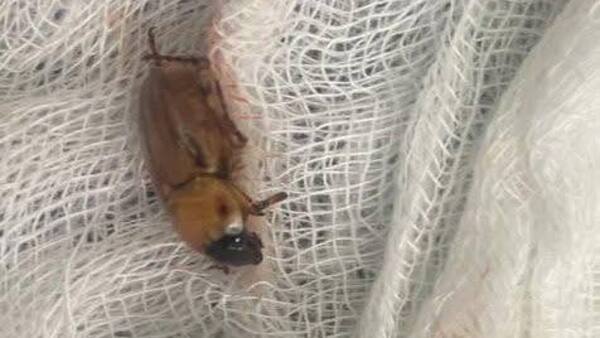 Lembú entró en el oído de una mujer que dormía y médicos extrajeron el bicho