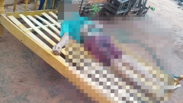 Murió atragantado mientras almorzaba con su hermano