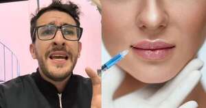 La Nación / “No sos Kim Kardashian”: odontólogo paraguayo arremete contra los labios grandes