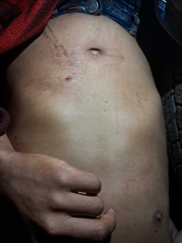 Hombre herido con arma blanca en comunidad indígena de Alto Verá
