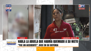 Investigan en Luque presunto caso de violencia intrafamiliar tras grave quemadura a niño de 3 años