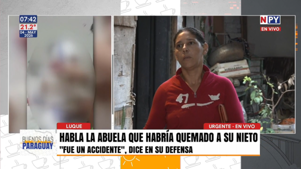 Investigan en Luque presunto caso de violencia intrafamiliar tras grave quemadura a niño de 3 años
