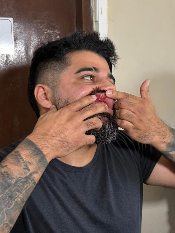Chofer de Bolt imputado por homicidio: «No tuve intención de que pase lo que pasó»