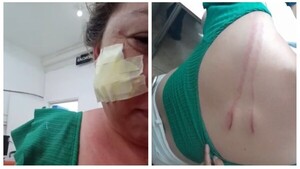 Le guacheó y cortó la cara porque se negó a bailar con él en una carrera de caballos