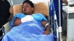 “No se hicieron cargo”: joven perdió la mano y acusa abandono de empresa de Hambre Cero