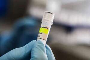 Casos de hantavirus en Paraguay: ¿dónde y quiénes son los más afectados? - Nacionales - ABC Color
