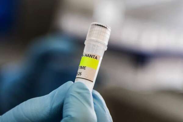 Casos de hantavirus en Paraguay: ¿dónde y quiénes son los más afectados? - Nacionales - ABC Color