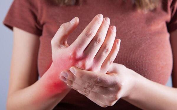 Día Mundial del Lupus: Visibilizando una enfermedad silenciosa y complicada