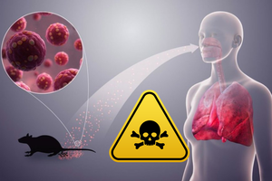 Hantavirus: ¿Cómo se contagia y qué precauciones tomar ante una enfermedad que no tiene cura?